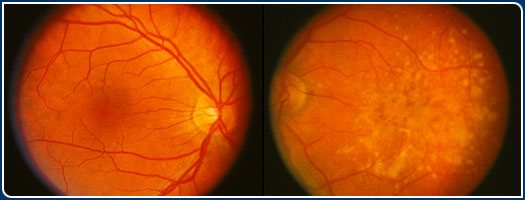 Fundus