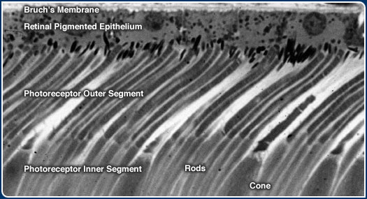 Outer Retina