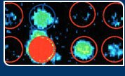 DNA Gene Array